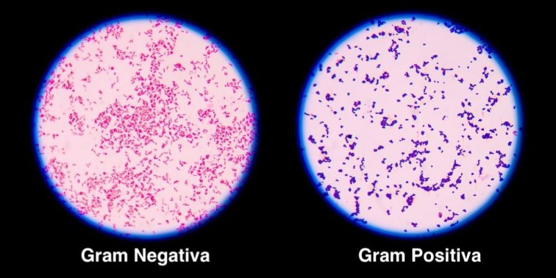 reino monera gram positiva negativa